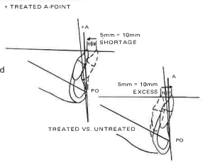 Manual Illustration